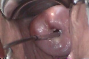 Cervix Play Insertion. Uterus Fucking